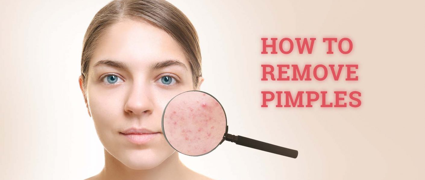 pimples