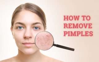 pimples