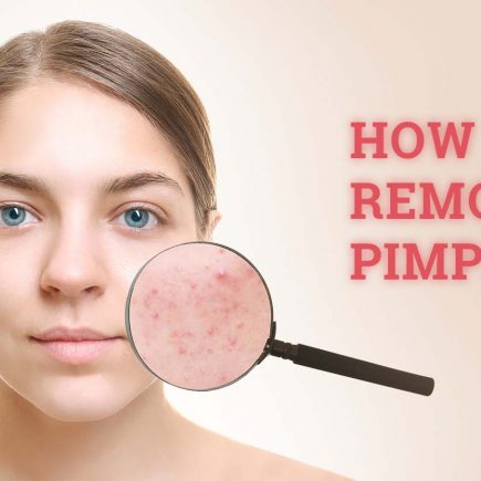 pimples