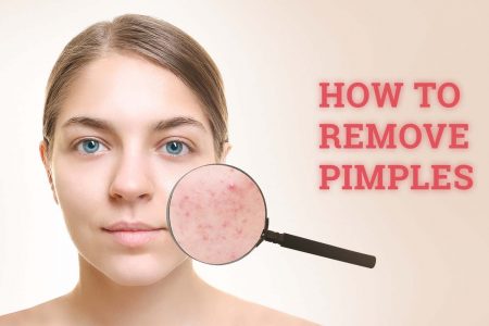 pimples