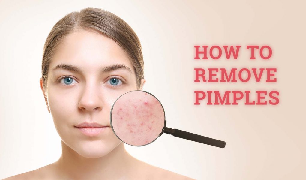 pimples